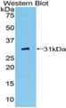 Western Blot; Sample: Recombinant protein.