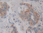 DAB staining on fromalin fixed paraffin- embedded stomach tissue)