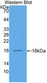 Western Blot; Sample: Recombinant protein.