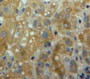 Used in DAB staining on fromalin fixed paraffin-embedded Liver tissue