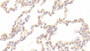 DAB staining on IHC-P; Samples: Human Lung Tissue;  Primary Ab: 20μg/ml Rabbit Anti-Human TARC Antibody Second Ab: 2µg/mL HRP-Linked Caprine Anti-Rabbit IgG Polyclonal Antibody 