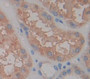 Thymus Activation Regulated Chemokine (Tarc) Polyclonal Antibody, Cat#CAU25698