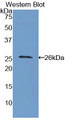 Western Blot; Sample: Recombinant protein.