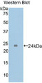 Western Blot; Sample: Recombinant protein.