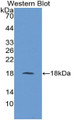 Western Blot; Sample: Recombinant protein.