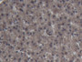 DAB staining on IHC-P; Samples: Porcine Liver Tissue; Primary Ab: 20µg/ml Rabbit Anti-Porcine FABP1 Antibody Second Ab: 2µg/mL HRP-Linked Caprine Anti-Rabbit IgG Polyclonal Antibody