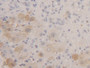 DAB staining on IHC-P; Samples: Human Liver Tissue