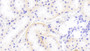 DAB staining on IHC-P; Samples: Rat Kidney Tissue; Primary Ab: 10μg/ml Rabbit Anti-Rat CYP21B Antibody Second Ab: 2µg/mL HRP-Linked Caprine Anti-Rabbit IgG Polyclonal Antibody