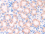 DAB staining on IHC-P; Samples: Mouse Kidney Tissue; Primary Ab: 10µg/ml Rabbit Anti-Mouse CYP21B Antibody Second Ab: 2µg/mL HRP-Linked Caprine Anti-Rabbit IgG Polyclonal Antibody
