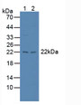 Western Blot; Sample: Lane1: Rat Liver Tissue; Lane2: Rat Spleen Tissue.