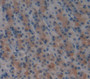 Used in DAB staining on fromalin fixed paraffin- embedded Kidney tissue