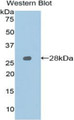 Western Blot; Sample: Recombinant protein.