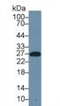 Western Blot; Sample: Human Serum; Primary Ab: 1µg/ml Rabbit Anti-Human SAP Antibody Second Ab: 0.2µg/mL HRP-Linked Caprine Anti-Rabbit IgG Polyclonal Antibody