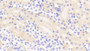 DAB staining on IHC-P; Samples: Mouse Kidney Tissue; Primary Ab: 20μg/ml Rabbit Anti-Mouse CSE Antibody Second Ab: 2µg/mL HRP-Linked Caprine Anti-Rabbit IgG Polyclonal Antibody