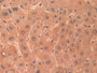 DAB staining on IHC-P; Samples: Human Liver Tissue; Primary Ab: 10µg/ml Rabbit Anti-Human CSE Antibody Second Ab: 2µg/mL HRP-Linked Caprine Anti-Rabbit IgG Polyclonal Antibody