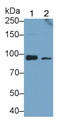 Western Blot; Sample: Recombinant RIG1, Human.