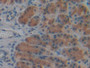 DAB staining on IHC-P; Samples: Rat Stomach Tissue; Primary Ab: 10µg/ml Rabbit Anti-Rat CYPD Antibody Second Ab: 2µg/mL HRP-Linked Caprine Anti-Rabbit IgG Polyclonal Antibody