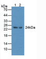 Western Blot; Sample: Lane1: Rat Marrow Tissue; Lane2: Rat Thymus Tissue.