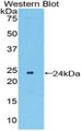 Western Blot; Sample: Recombinant protein.