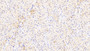 DAB staining on IHC-P; Samples: Human Cardiac Muscle Tissue;  Primary Ab: 20μg/ml Rabbit Anti-Human PARC Antibody Second Ab: 2µg/mL HRP-Linked Caprine Anti-Rabbit IgG Polyclonal Antibody 