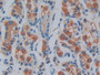 DAB staining on IHC-P; Samples: Human Stomach Tissue; Primary Ab: 10µg/ml Rabbit Anti-Human IRAK2 Antibody Second Ab: 2µg/mL HRP-Linked Caprine Anti-Rabbit IgG Polyclonal Antibody