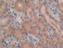 DAB staining on IHC-P; Samples: Mouse Kidney Tissue; Primary Ab: 10µg/ml Rabbit Anti-Mouse IL5Ra Antibody Second Ab: 2µg/mL HRP-Linked Caprine Anti-Rabbit IgG Polyclonal Antibody