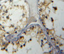 DAB staining on fromalin fixed paraffin-embedded testis tissue)