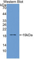 Western Blot; Sample: Recombinant protein.