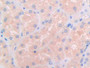 DAB staining on IHC-P; Samples: Human Kidney Tissue; Primary Ab: 30µg/ml Rabbit Anti-Human IL3Ra Antibody Second Ab: 2µg/mL HRP-Linked Caprine Anti-Rabbit IgG Polyclonal Antibody