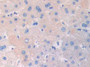 DAB staining on fromalin fixed paraffin- embedded kidney tissue)