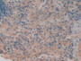 DAB staining on IHC-P; Samples: Rat Spleen Tissue; Primary Ab: 10µg/ml Rabbit Anti-Rat TNFRSF1B Antibody Second Ab: 2µg/mL HRP-Linked Caprine Anti-Rabbit IgG Polyclonal Antibody