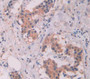 Tumor Necrosis Factor Receptor Superfamily, Member 1B (Tnfrsf1B) Polyclonal Antibody, Cat#CAU25802