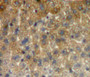 DAB staining on fromalin fixed paraffin-embedded liver tissue)