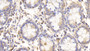 DAB staining on IHC-P; Samples: Human Colon Tissue; Primary Ab: 20μg/ml Rabbit Anti-Human PDIA3 Antibody Second Ab: 2µg/mL HRP-Linked Caprine Anti-Rabbit IgG Polyclonal Antibody