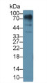 Western Blot; Sample: Human Lung lysate; Primary Ab: 1µg/ml Rabbit Anti-Human LUM Antibody Second Ab: 0.2µg/mL HRP-Linked Caprine Anti-Rabbit IgG Polyclonal Antibody