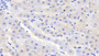 DAB staining on IHC-P; Samples: Bovine Liver Tissue;  Primary Ab: 20μg/ml Rabbit Anti-Bovine SDH Antibody Second Ab: 2µg/mL HRP-Linked Caprine Anti-Rabbit IgG Polyclonal Antibody 