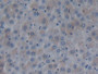 DAB staining on IHC-P; Samples: Rat Liver Tissue