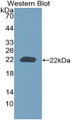 Western Blot; Sample: Recombinant protein.