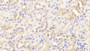 DAB staining on IHC-P; Samples: Mouse Kidney Tissue; Primary Ab: 20μg/ml Rabbit Anti-Mouse CRT Antibody Second Ab: 2µg/mL HRP-Linked Caprine Anti-Rabbit IgG Polyclonal Antibody