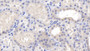 DAB staining on IHC-P; Samples: Human Kidney Tissue; Primary Ab: 20µg/ml Rabbit Anti-Human CRT Antibody Second Ab: 2µg/mL HRP-Linked Caprine Anti-Rabbit IgG Polyclonal Antibody