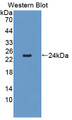 Western Blot; Sample: Recombinant CDH2, Mouse.