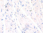 DAB staining on IHC-P; Samples: Mouse Heart Tissue; Primary Ab: 30µg/ml Rabbit Anti-Mouse CDH2 Antibody Second Ab: 2µg/mL HRP-Linked Caprine Anti-Rabbit IgG Polyclonal Antibody