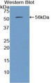 Western Blot; Sample: Recombinant protein.