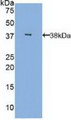 Western Blot; Sample: Recombinant MBL, Human.