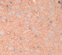 Matrix Gla Protein (Mgp) Polyclonal Antibody, Cat#CAU25864