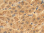 DAB staining on IHC-P; Samples: Human Liver Tissue; Primary Ab: 20µg/ml Rabbit Anti-Human MGP Antibody Second Ab: 2µg/mL HRP-Linked Caprine Anti-Rabbit IgG Polyclonal Antibody