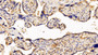 DAB staining on fromalin fixed paraffin-embedded Liver tissue)