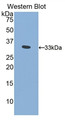 Western Blot; Sample: Recombinant protein.