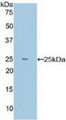 Western Blot; Sample: Recombinant MPL, Mouse.