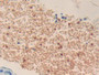 DAB staining on IHC-P; Samples: Mouse Lung Tissue